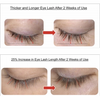 PRO/Line Eyeliner Treatment | Lash serum   Eyeliner